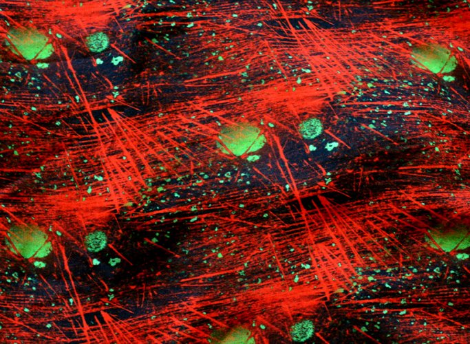 Actin Cytoskeleton Fabric