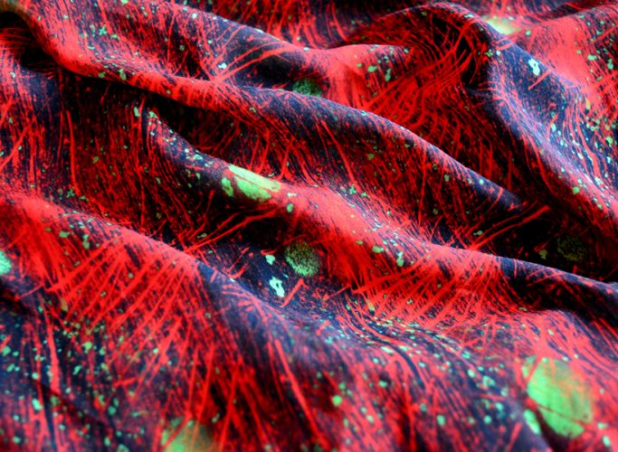 actin cytoskeleton fabric