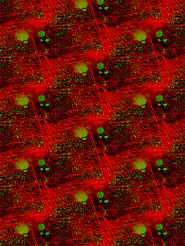 Actin Cytoskeleton Fabric